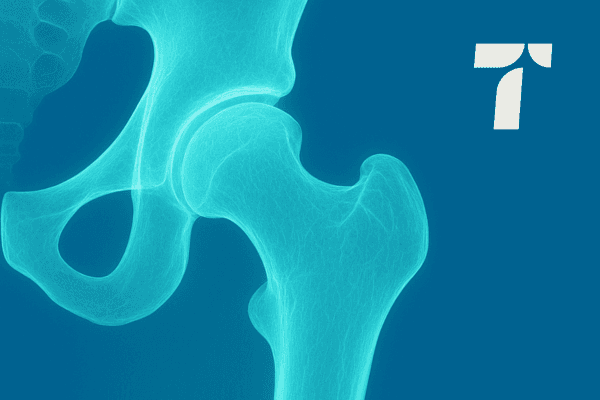 Tarabichi Hip & Knees