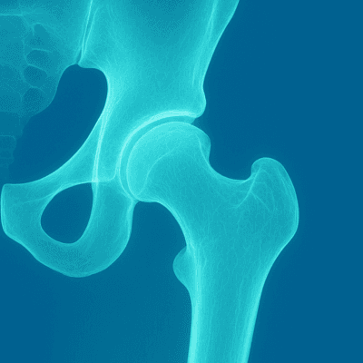 Tarabichi Hip & Knees