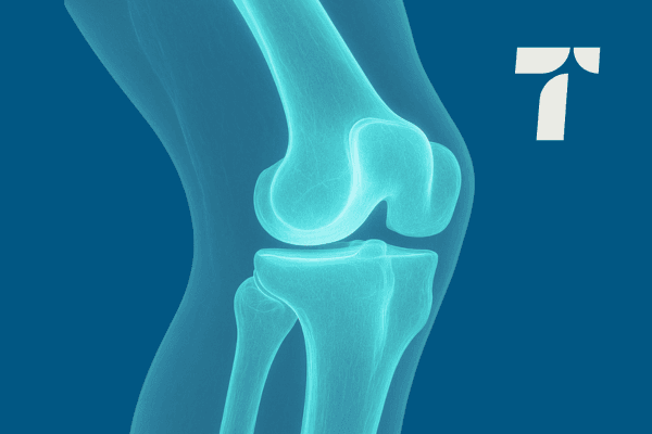 Tarabichi Hip & Knees