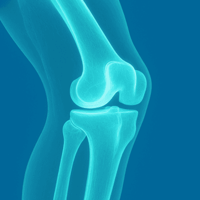 Tarabichi Hip & Knees